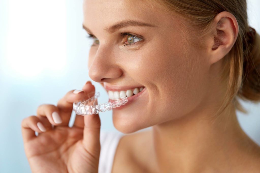 Invisalign-Behandlung in Genf