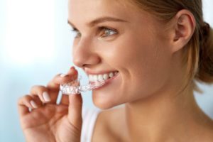 Tratamiento Invisalign en Ginebra