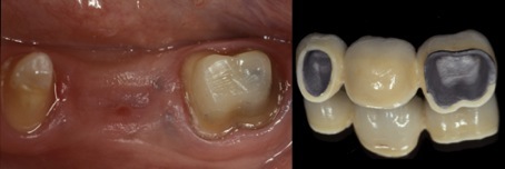 dental_reconstruction