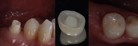 dental_reconstruction