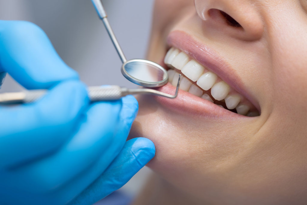 Hygiéniste dentaire à Genève
