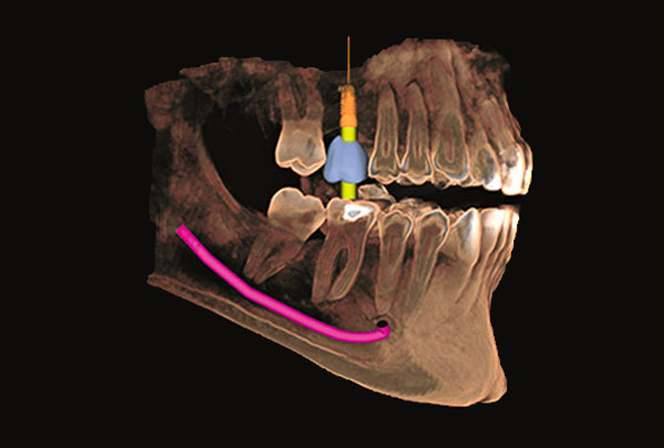 Radiografia 3D