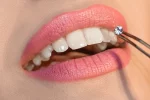 dental rhinestones
