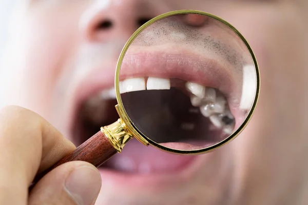 wie man einen fehlenden Zahn ersetzt