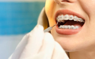 orthodontiste
