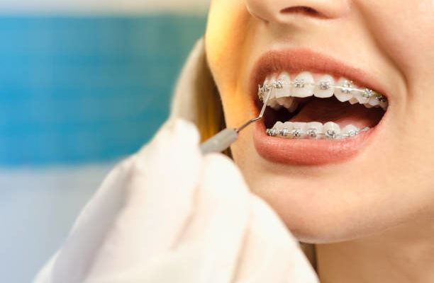 orthodontiste geneve