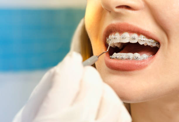 orthodontiste
