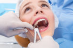 Extraction dents