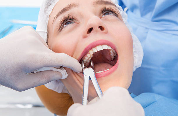 Extraktion von Zähnen