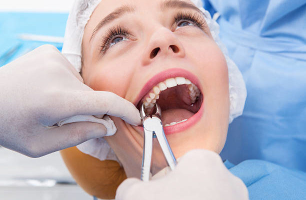 Tooth extraction